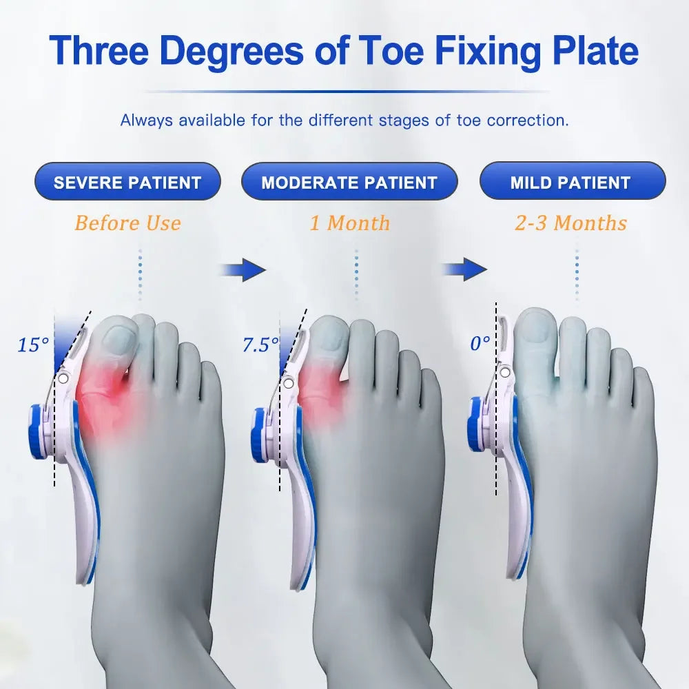 Big Toe Straightener Corrector Bunion Corrector Adjustable Toe Separator Orthopedic Brace Pain Relief